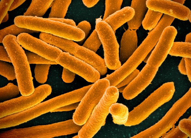 A microscope image of E. coli bacteria colored orange against a dark background.