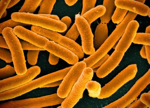 A microscope image of E. coli bacteria colored orange against a dark background.