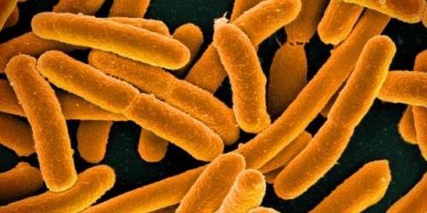 A microscope image of orange-colored E. coli bacteria cells against a dark background